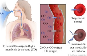 intoxicación por monóxido de carbono